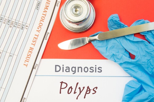 Gallbladder Polyps What to Do?